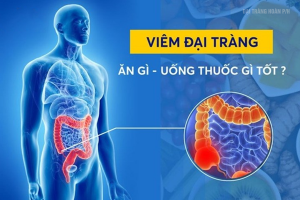 Cảnh báo triệu chứng viêm đại tràng – Nguyên nhân, cách chữa