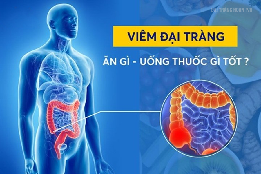 Cảnh báo triệu chứng viêm đại tràng – Nguyên nhân, cách chữa